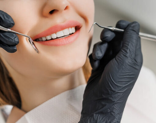 Close-up of female smile with white teeth during medical examination