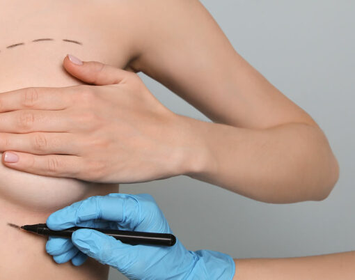 Doctor drawing marks on female breast for cosmetic surgery operation against color background