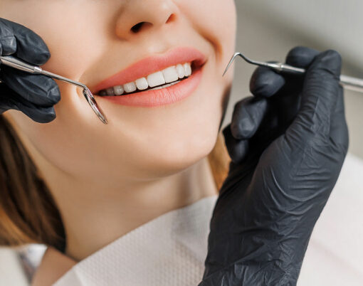 Banner for dental theme. Close-up of female smile with white teeth during medical examination. Concept of tooth whitening, treatment, veneers, professional clinic. Photo with free copy space.
